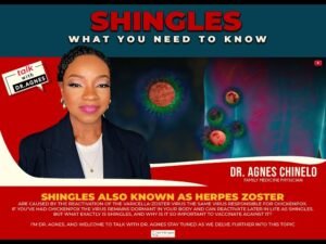 Shingles -What You Need to Know